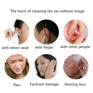 Ear Cleaning Endoscope Camera 5.5mm 0.3mp 3in1 Visual Ear Pick USB Ear Spoon Type-c Ear Otoscope Borescope for Android (9)
