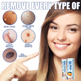 【EELHOE】Warts Remover Original Cream Skin Hyperplasia Kulugo Removal Effectively Warts Remover(20G) (6)