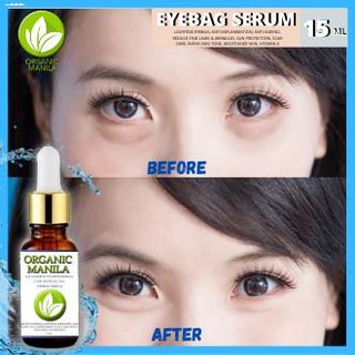 Body Masks㍿⊙✽Eyebag Remover by Organic Manila with Anti-ageing, Even Skin Tone, Vit A, Scar Care
