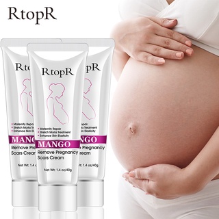 ✕❆3Pcs Remove Pregnancy Scars Skin Body Cream Postpartum Stretch Marks Repair Cream Anti-Aging Skin