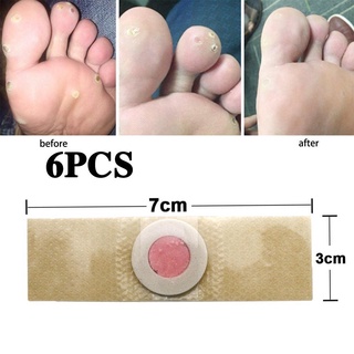 【Ready Stock】6 Pcs Removal Patch Toe Callus Remover Pads Wart Treatment Patch For Foot