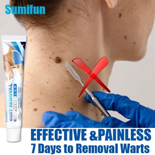 Sumifun Warts Remover Cream Herbal Wart Treatment Wart Removal Ointment Wart Treatment Corn Plaster