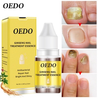 OEDO Antibacterial Nail Treatments Essential Extract Nail Fungus Serum Remove Onychomycosis Toe Nour