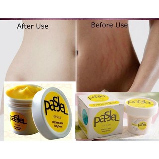 New productsↂpasjel Pregnant woman Stretch mark repair cream