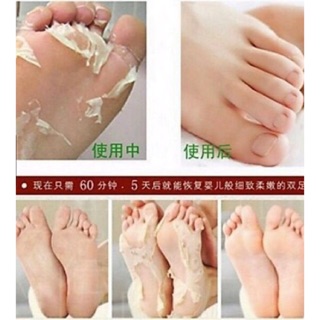 ✅COD/FREE SF❗️ PINX Foot Care Peeling Mask (1)