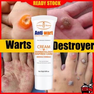Warts Remover Cream Body Skin Tag Remover Very Effective Antibacterial Wart Remover Ointment (2)
