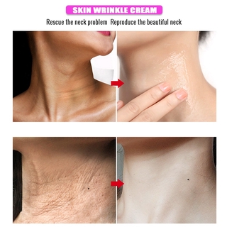 Neck cream wrinkle whitening cream thin fine lines neck moisturizing massage cream remove wrinkles (6)