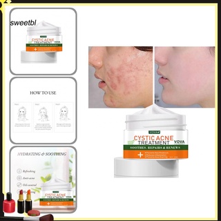 SWEN Rejuvenate Skin Face Cream Natural Moisturizing Mild Acne Cream Anti-Aging for Face