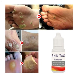 beauty☸✙Genital Wart Treatment Papillomas Removal of Warts Liquid From Skin Warts Romover Oil PH