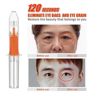 ♕ exo ღ Active Eye Cream Remove Eye Bags Dark Circles Anti-drying