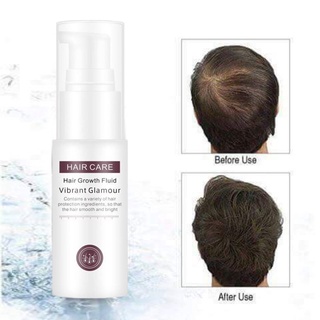 Vibrant Glamour Hair Grower Spray Hair Care Hair Growth Serum Fluid Treatment 30ml