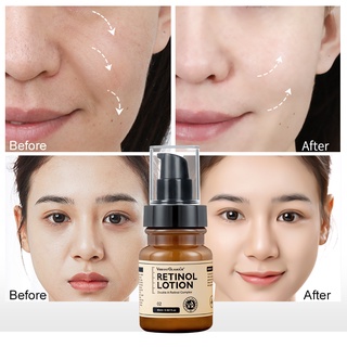 Double Retinol Face Toner Serum Lotion Whitening Cream Set Anti-aging Remove Wrinkle Fade Fine Line (5)