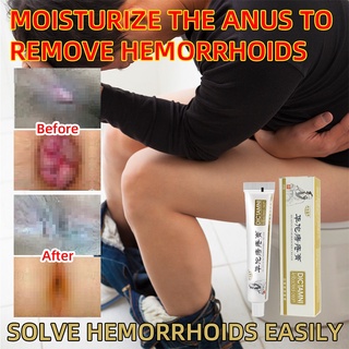 Hua Tuo Hemorrhoids Ointment Hemorrhoids Treatment Ointment Cream Health Care Hemorrhoid Cream(20g)