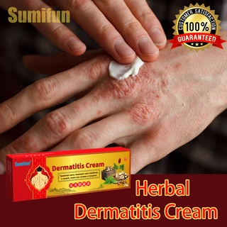 SUMIFUN Psoriasis Cream/Dermatitis Cream with Herbal Ingredients for Skin Itching 20g