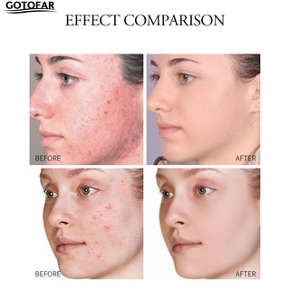 gotofar Rejuvenate Skin Skin Cream Treatment Soothes Repairs Renews Skin Cream Anti-Aging for Face (3)