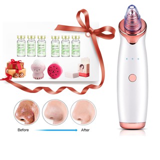 5 Tips Remove blackheads remove pores acne vacuum suction facial beauty and skin cleaning tools (1)