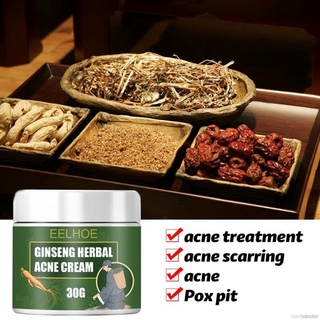 Natural Ginseng Herbal Acne Cream Cleans And Fades Acne Scars To Acne Repair Acne Pits Acne Cream