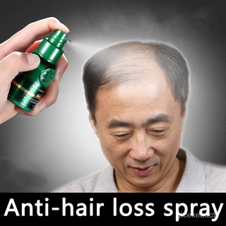 Anti-hair loss spray Nourish hair roots and relieve hair loss Anti-hair loss 30ml Nourish and grow h