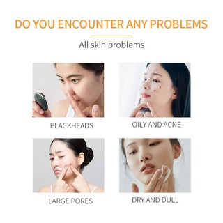 Aliver Amino Acid Facial Cleanser Oil Control Skin Care Dry Skin Acne Elimination Shrinks Pores 120g (7)