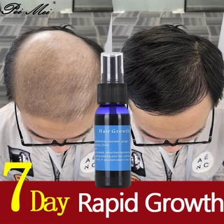 Hair Grower for Men Women Hair Treatment Hair Growth Spray Essence Hair Loss Preventing Baldness (1)