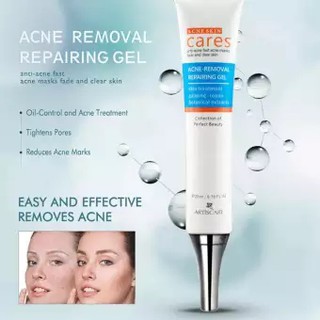 pimple remover acne marks remover skin care products anti Acne Treatment Face Serum Anti-Acne (5)