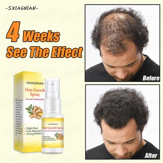 SXIAGNIAN Hair Growth Spray Essential Oil Hair Grower Hair Care Stimulates Rapid Hair Growth 20ml