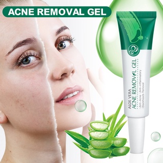 Cream Aloe Soothing Gel Aloe Vera Gel Skin Care Remove Acne Moisturizing Day Cream After Sun Lotions