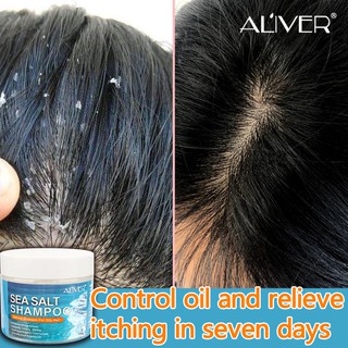 ALIVER Shampoo Anti-dandruff shampoo Hair Treatment Shampoo psoriasis shampoo Sea Salt Shampoo