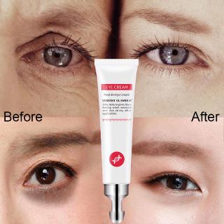 Eye Cream Anti-Blu-ray ANR Eye Repair Eye Cream Anti-Wrinkle/Fine Eye Cream Peptide Collagen Serum Anti-Wrinkle Anti-Age Remover Dark Circles Eye Care Against Puffiness And Bags