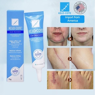 Scar Remover Gel Cream Surgical Stretch Marks Repair Cream peklat remover acne Scar Removal for legs