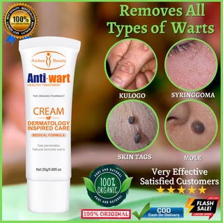 Warts Remover Cream Body Skin Tag Remover Very Effective Antibacterial Wart Remover Ointment (1)