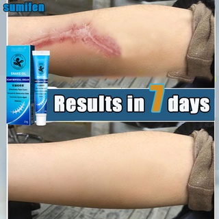 【Sumifun】 Scar Remover Old Scar Gel Cream Acne Treatment Whitening Moisturizer Serum Skin Care (1)