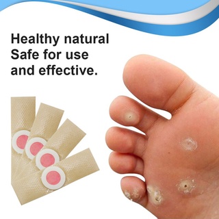 Aliver Corn Removal Patch Toe Callus Corn Remover Pads Wart Treatment Patch For Foot (7)