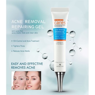 Acne scar removal Freckle Cream Extract Scars Marks Treatment Facial Acne Cream (2)