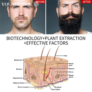 YOUNGCOME Men's Beard Essential Growth Oil Beard Growth Fluid Repair Hair Follicle Growth Moustache (8)