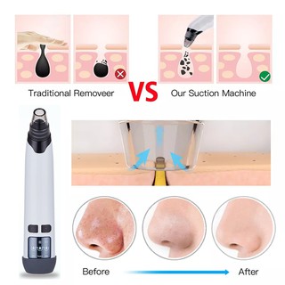 Electric Blackhead Remover Face Pore Cleaner Acne Pimple Removal Vacuum Suction Facial Machine (2)