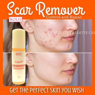[MS.LOVELY] SCAR REMOVER Acne Scar Treatment Whitening Moisturizer Serum Skin Care Repair 10ml