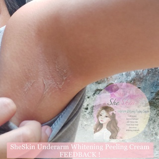 Underarm whitening peeling cream