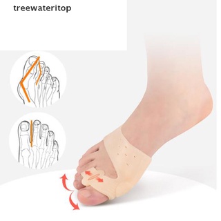 (hot*) Big Toe Splint Separator Hallux Valgus Bunion Corrector Orthotic Feet Care Thumb treewateritop