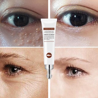 Eye Cream for Dark Circle Eyebag Dark Circle Remover Cream Eye Bags Wrinkles Removal Cream Skin Care