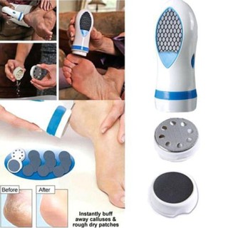 Pedi Spin Gently Remover Calluses & Dry skin (1)