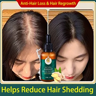 Hair Serum Castor Oil For Hair Growth Hair Grower Fast Long Hair Ginger Natural Plant Extract, Anti