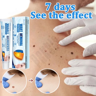 Warts Removal Ointment Original Cream Effectively Remover Skin Tags Mole and Warts Remover【20g】