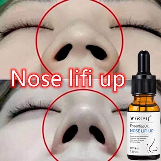 [Ready Stock] Nose up Essential Oil Nose Lifting Beauty Professional Rhinoplasty Essence care 10ml