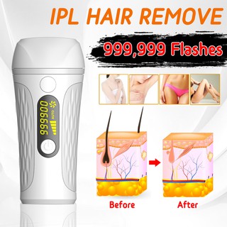 ★Hot★ Laser Hair Removal Device Epilator Permanent Electric 3 in 1 IPL Hair Removal 999999 Flashes Universal voltage (1)