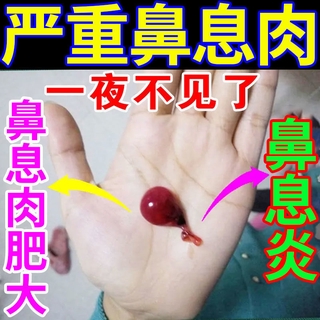 READY STOCK 【Nasal Polyps Fell off】Small Centipeda Herb Miao Jia Tu Fang Rhinitis Cream Special Effe