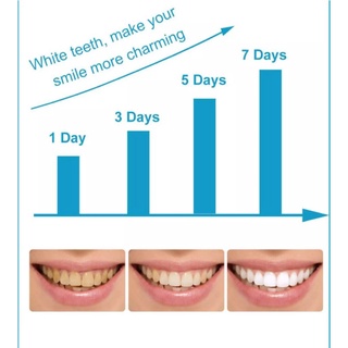Okany's teeth whitening pen teeth whitener toothpast Products Perfect Smile Tooth Gel Whitener 5g (6)