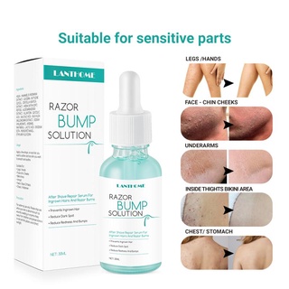 30ml Razor Bumps Solution For Ingrown Hair Inhibitor Hair Remover And Growth Inhibitor TSLM1