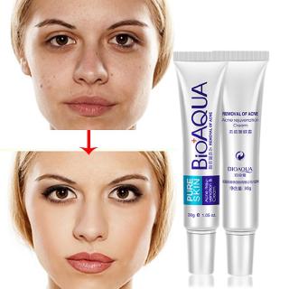 BIOAQUA 30g Anti Acne Cream / Oil Control / Acne Scar Remove Women's Beauty