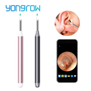 Yongrow Medical HD Camera Wireless Visual Otoscope Ear Cleaner Ear Wax Wifi Wireless Otoscope Ear